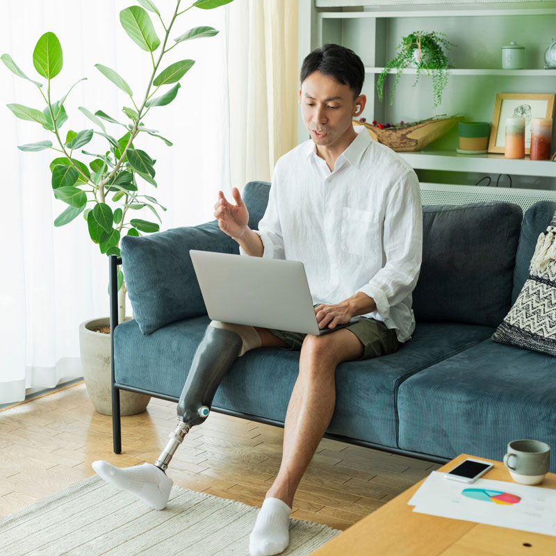 A man sitting on a couch with a laptop, he has a prosthetic leg